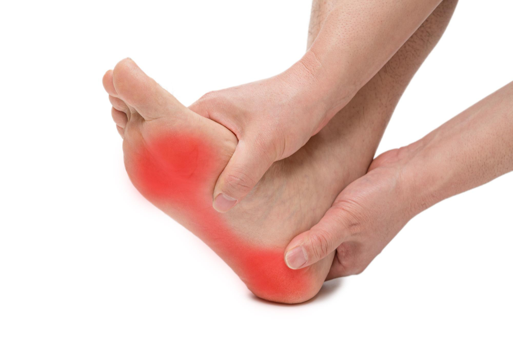 Plantar Fasciitis: Causes, Symptoms, Diagnosis, and Effective Treatment