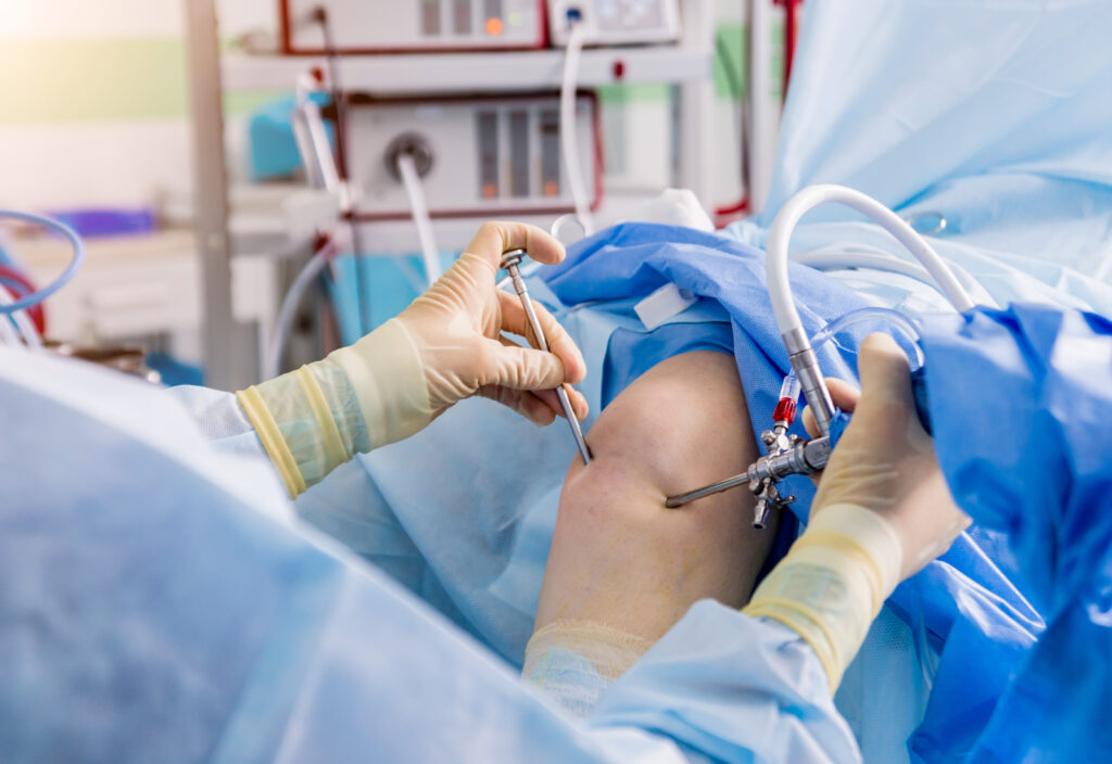 Knee Arthroscopy: Procedure, Recovery, and What to Expect