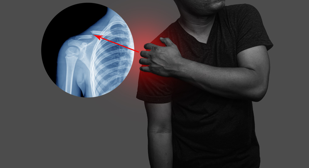 Shoulder Arthroscopy: Risks Vs Benefits